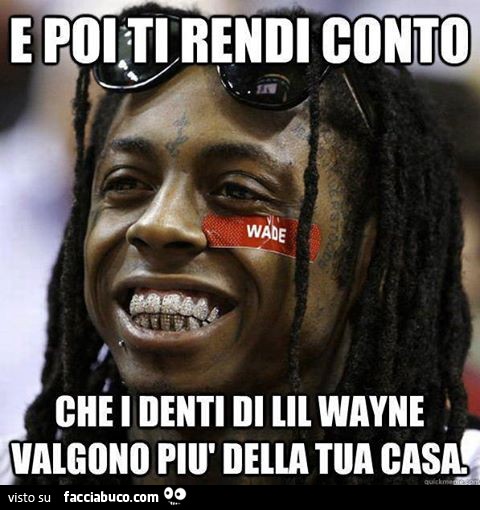 E poi ti rendi conto che i denti di Lil Wayne valgono più della tua casa