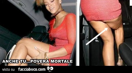 Rihanna. Anche tu povera mortale hai la cellulite