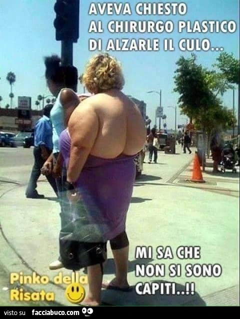 Aveva chiesto al chirurgo plastico di alzarle il culo. Mi sa che non si sono capiti