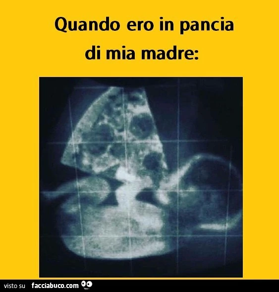 Quando ero in pancia di mia madre