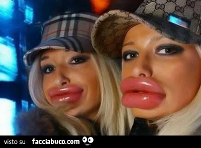 Ragazze con labbra giganti